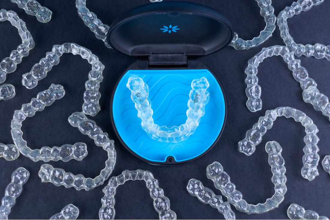 5 Things to Know Before Choosing Your Invisalign Provider